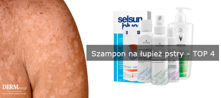 jaki szampon na lupiez pstry