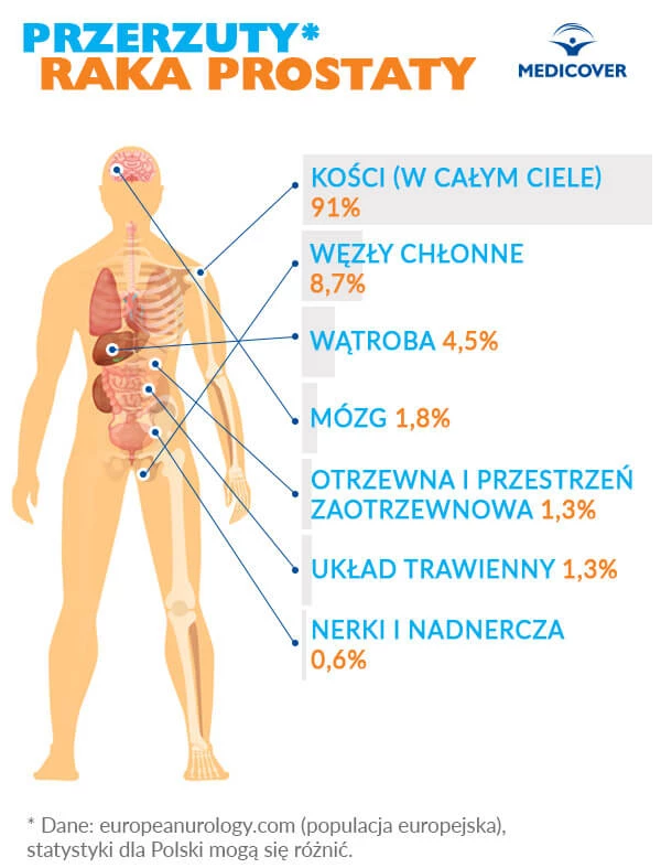 nowotwór prostaty czy należą się pieluchomajtki