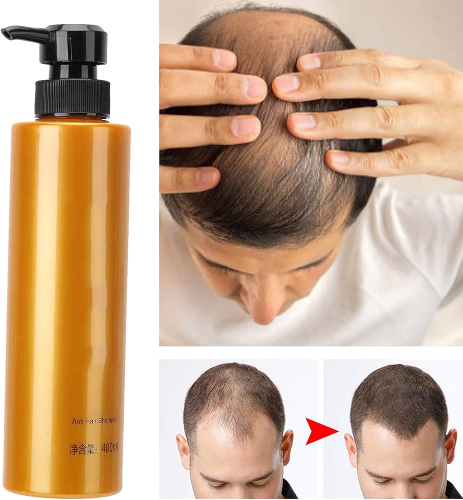 szampon na porost włosów dla łysych
