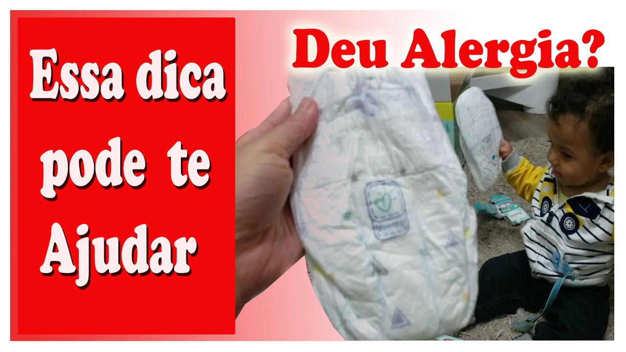 alergia pampers pants