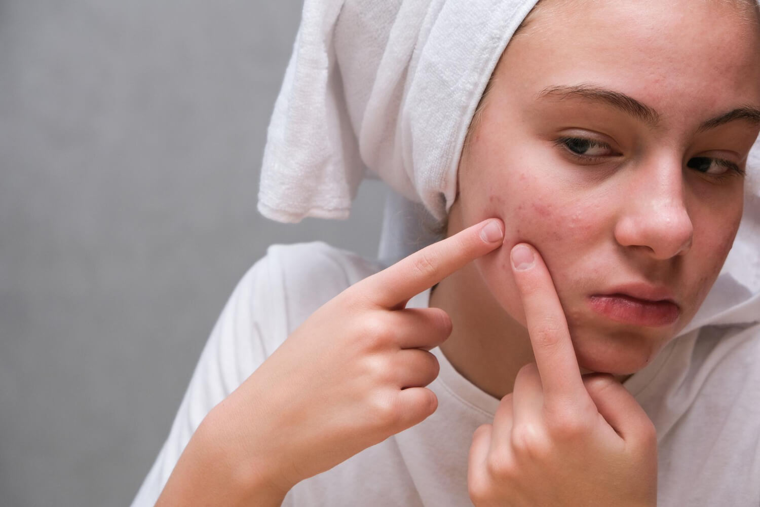 chusteczki nawilżane podcieranie ropne wypryski