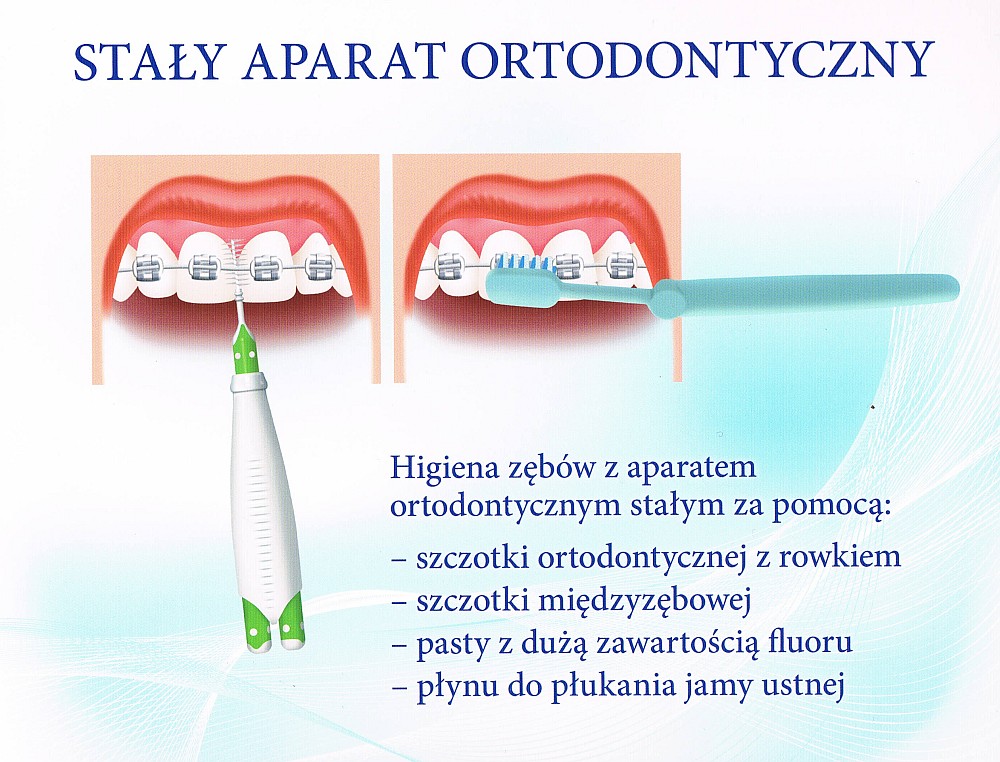 Hygiena jamy ustnej