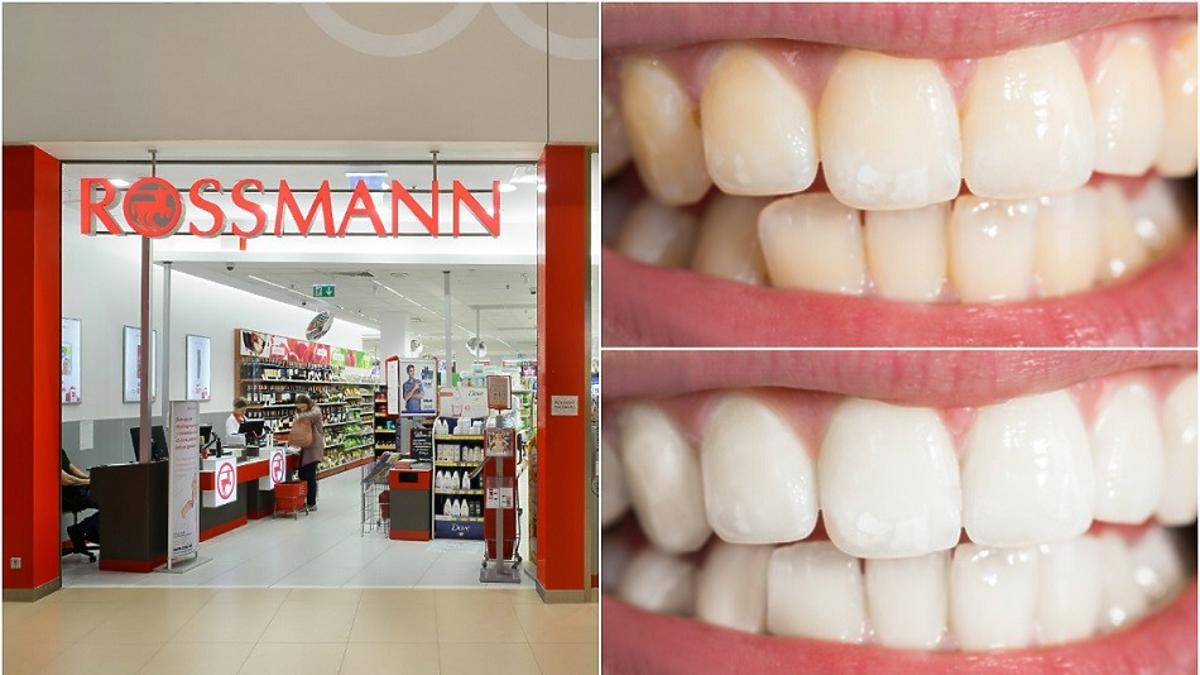 lakier do zębów rossmann