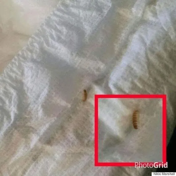 pinworm larvae in pampers